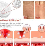 Derma Smooth Skin Tag Removal Patch