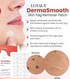 Derma Smooth Skin Tag Removal Patch