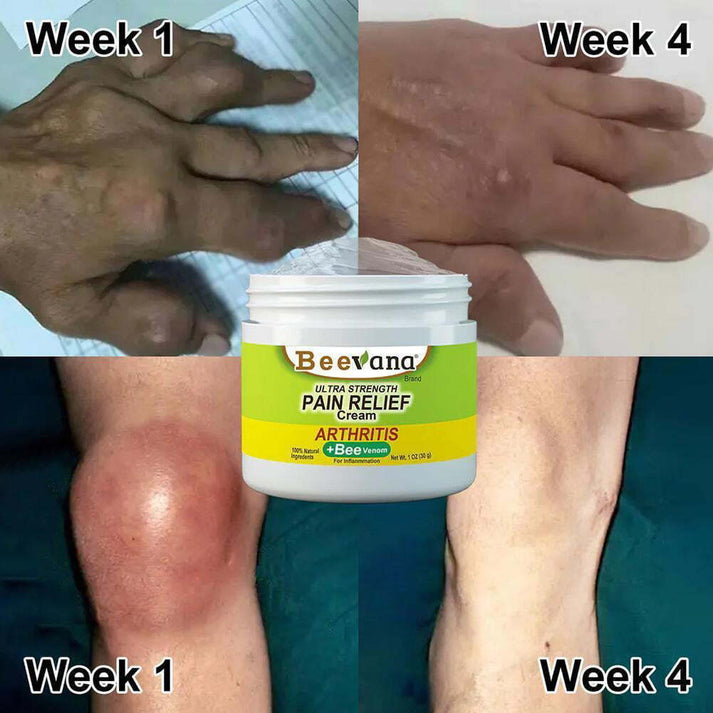 Bee Venom Ultra Strength Pain Relief Cream (Buy 1 Get 1 free)