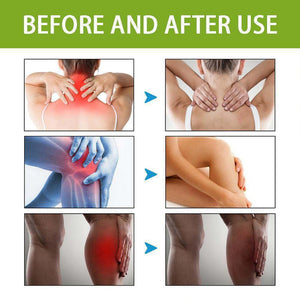 Bee Venom Ultra Strength Pain Relief Cream (Buy 1 Get 1 free)