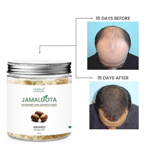 Jamalgota Hair Growth Powder - Buy 1 Get 1 FREE 😇 Pack of 2