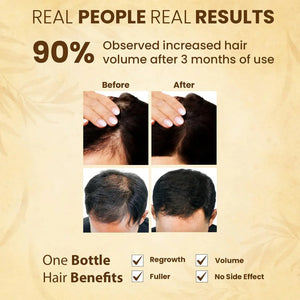 Jamalgota Hair Growth Powder - Buy 1 Get 1 FREE 😇 Pack of 2